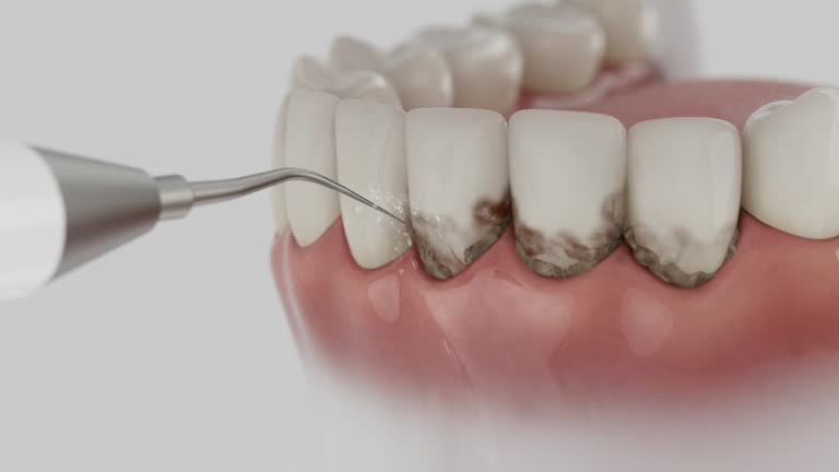 Reliable Tooth Extraction contractor in Big Spring, TX by Smile Center Dentistry